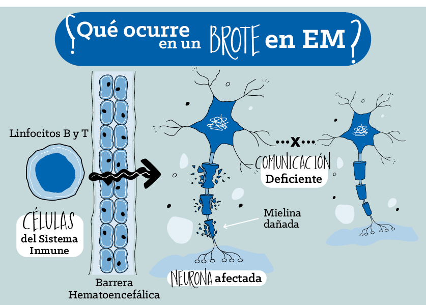 Brote De Esclerosis Múltiple: ¿Cómo Detectarlo? | Roche Pacientes